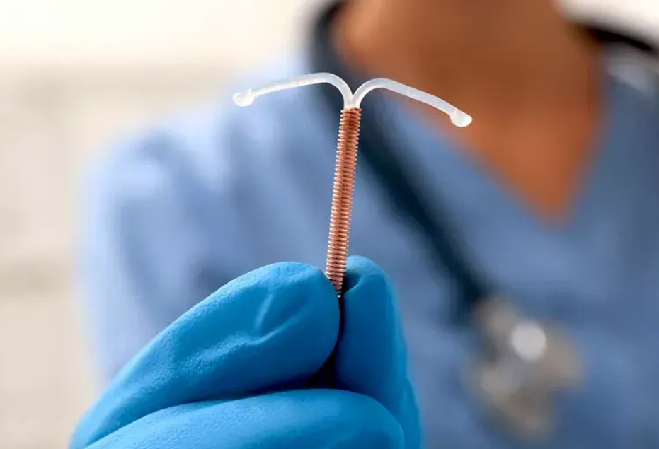Copper IUD – Hormone-Free & Lasts Up to 10 Years
